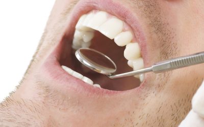 Teeth Cleaning: Is Brushing Enough or Do You Need a Pro?