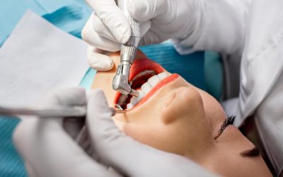 Teeth Cleaning vs. Whitening: Which One Gives You the Brightest Smile?
